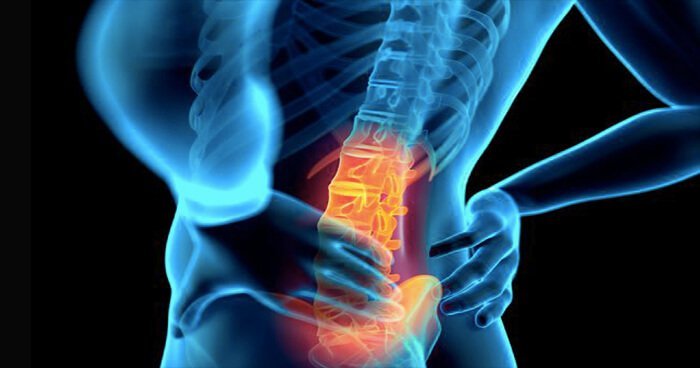FDA clears laser for persistent low lower back pain for first time