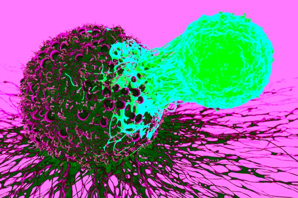 High blood strain, high ldl cholesterol early in life tied to coronary heart troubles later