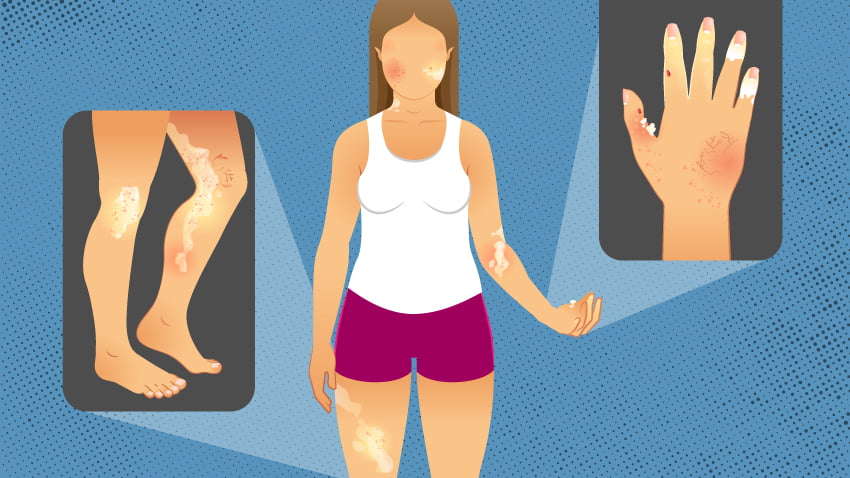 Telangana State mulls over inclusion of extra treatments in arogyasri scheme 1