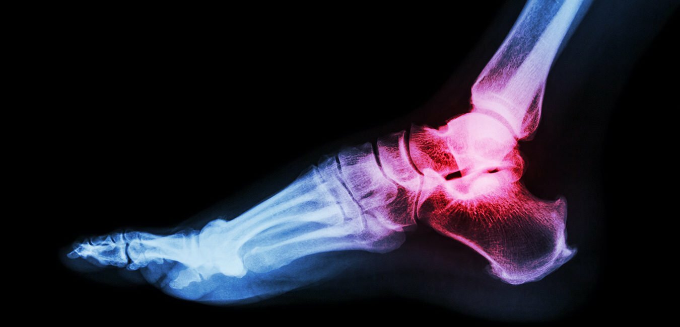 Heart Failure: 6 Most Important Causes You Must Know