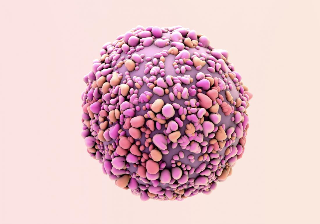 Area native designs bra for breast cancer patients