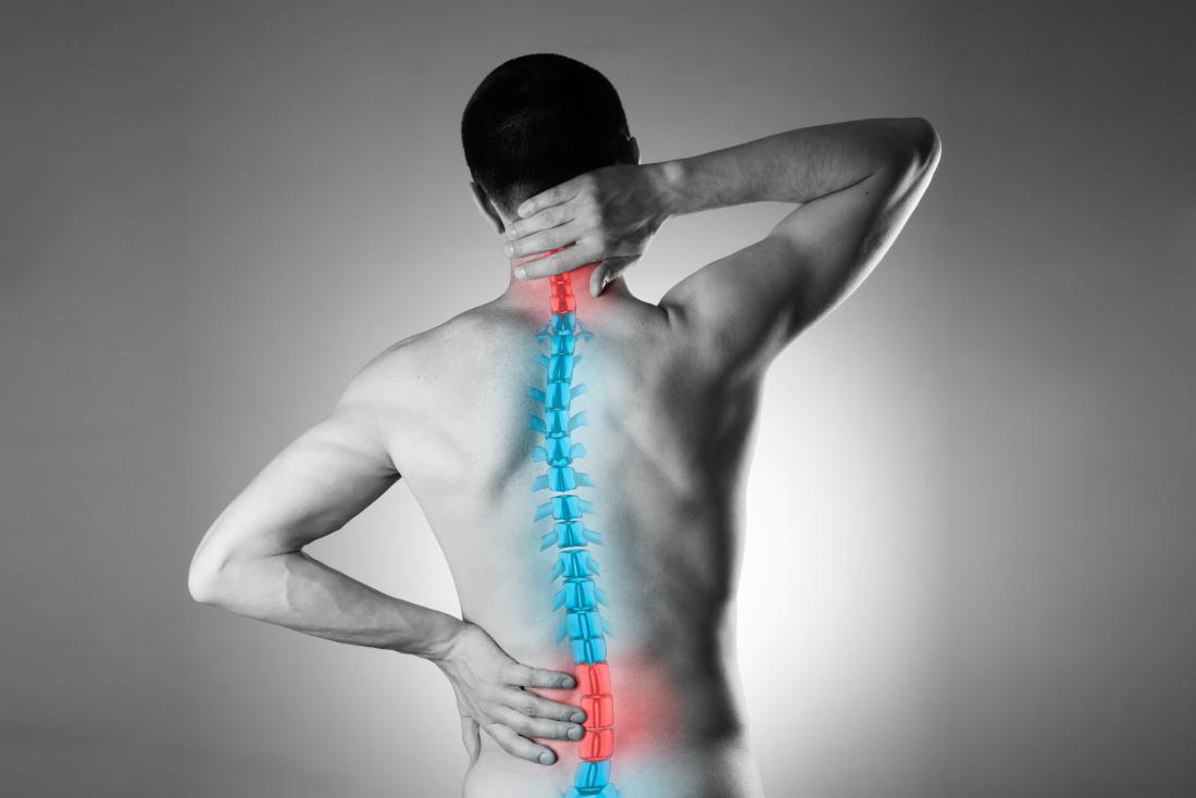 CMS May Cover Acupuncture as Opioid Alternative for Chronic Back Pain