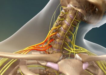 Brachial Plexus Injury: How to Treat it Without Surgery